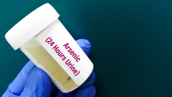 การวิเคราะห์ชนิดของสารหนูในปัสสาวะ (Arsenic Speciation in Urine)