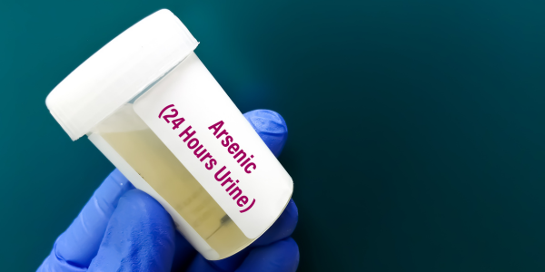 การวิเคราะห์ชนิดของสารหนูในปัสสาวะ (Arsenic Speciation in Urine)